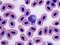 Phagocytic macrophage