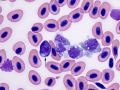 Phagocytic macrophages
