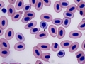 Polychromatophil