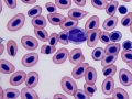 Toxic band neutrophil