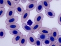 Basophil