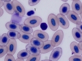Basophil