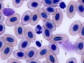 Neutrophil