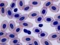 Thrombocyte