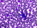 Colonic lymphoma & bugs (dog)