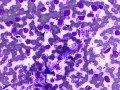 Colonic lymphoma & bugs (dog)