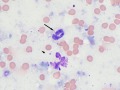 Mycobacteria