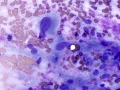 Sarcoma (cecum, dog)