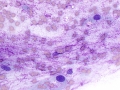 Sarcoma (cecum, dog)