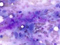 Sarcoma (cecum, dog)