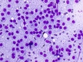 Mast cell tumor (DQ, cat)