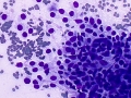 Mast cell tumor (DQ, cat)