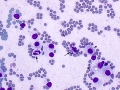 Mast cell tumor (DQ, cat)