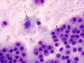 Mast cell tumor (Wright's, cat)