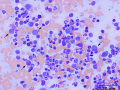 Suspect lymphoma (colon, cat)