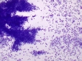 Mast cell tumor (DQ, cat)