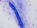 Villus and lymphocytes (duodenum)