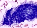 Gastric mucosa