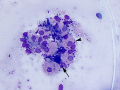 Parietal & chief cells