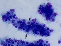 Parietal & chief cells (DQ)