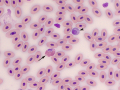 Heterophil & azurophil (Leopard gecko)
