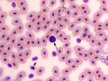 Eosinophil & thrombocyte (Leopard gecko)