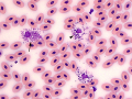 Light and dark eosinophils (Leopard gecko)