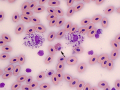Eosinophils & heterophil (Leopard gecko)