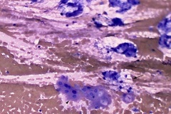 Glandular tissue