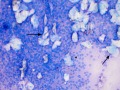 AGASACA & squames