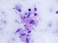 Apocrine anal sac adenocarcinoma