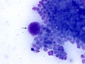 Apocrine anal sac adenocarcinoma