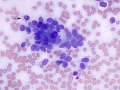 Complex mammary adenoma (dog)