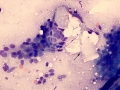 Mammary tumor (dog)