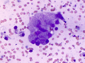 Unusual mammary epithelium