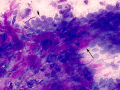 Mammary carcinoma (cat)