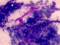 Mammary carcinoma (cat)