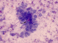 Mammary carcinoma (cat)