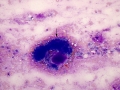 Mixed mammary tumor