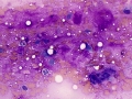 Mixed mammary tumor
