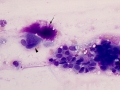 Mixed mammary tumor