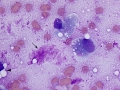 Mixed mammary tumor