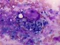 Mixed mammary tumor