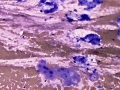Salivary gland