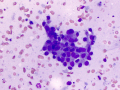 Normal mammary epithelium