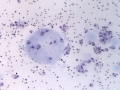 Sialocele