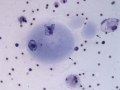 Sialocele