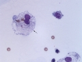 Sialocele