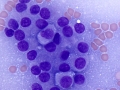 Thyroid C cell tumor (dog)