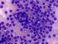 Thyroid C cell tumor (dog)
